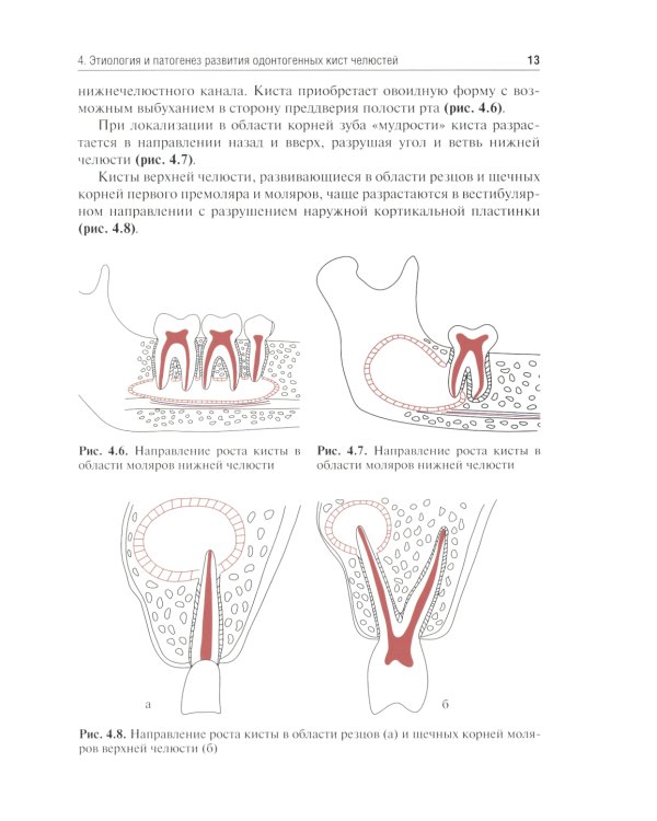 Одонтогенные кисты челюстей: Учебное пособие. 2-е изд., испр. и доп