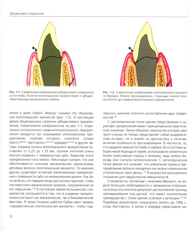Точная припасовка несъемных протезов. Клинические и зуботехнические этапы
