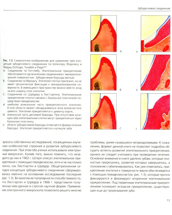 Точная припасовка несъемных протезов. Клинические и зуботехнические этапы