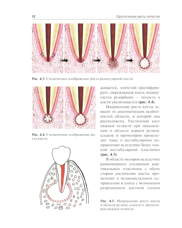 Одонтогенные кисты челюстей: Учебное пособие. 2-е изд., испр. и доп