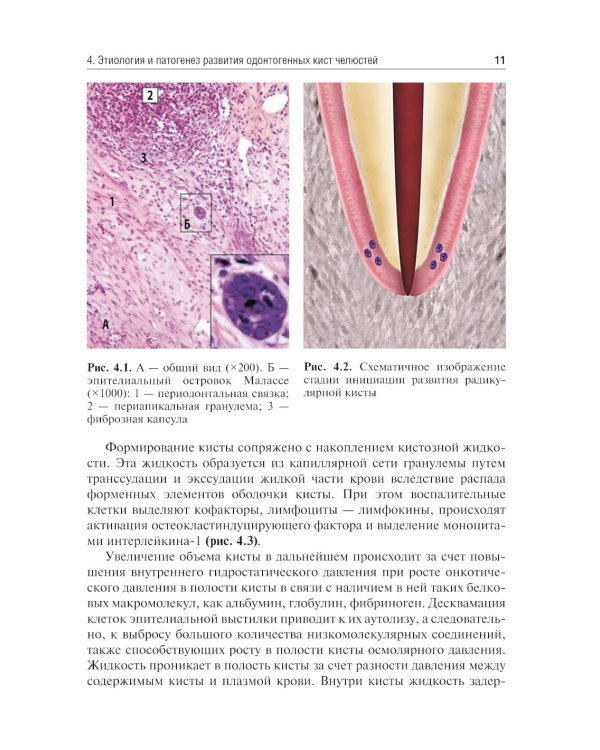 Одонтогенные кисты челюстей: Учебное пособие. 2-е изд., испр. и доп