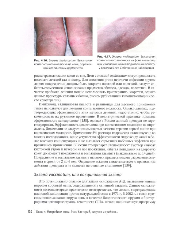 Атопический дерматит. Междисциплинарный подход к диагностике и лечению: руководство для врачей