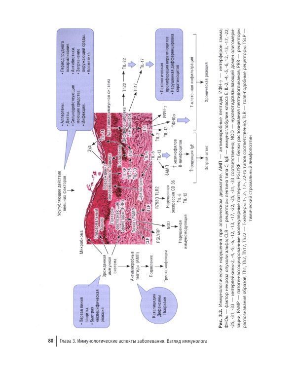 Атопический дерматит. Междисциплинарный подход к диагностике и лечению: руководство для врачей