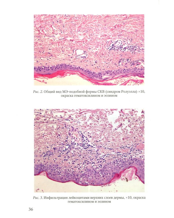 Клинические случаи клиники Факультетской терапии им. С.П. Боткина: многогранность ревматологической патологии: Учебное пособие