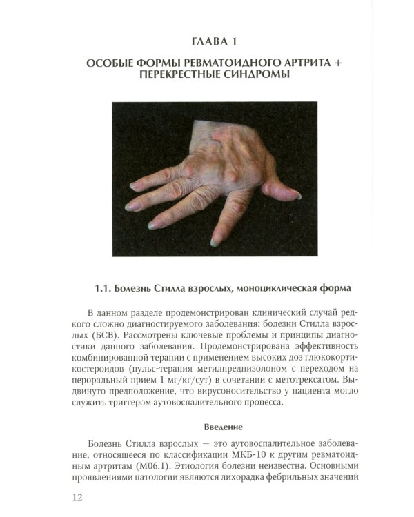 Клинические случаи клиники Факультетской терапии им. С.П. Боткина: многогранность ревматологической патологии: Учебное пособие