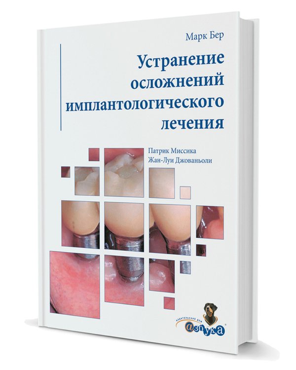 Устранение осложнений имплантологического лечения