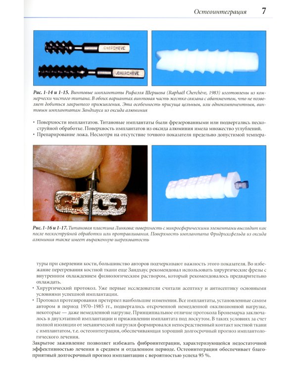 Устранение осложнений имплантологического лечения