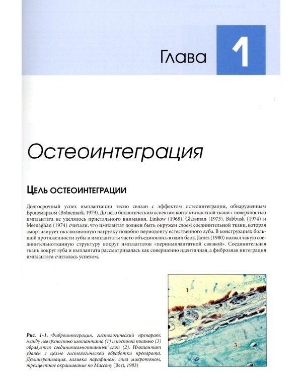 Устранение осложнений имплантологического лечения