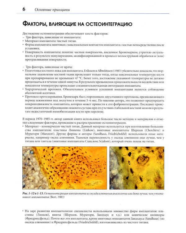 Устранение осложнений имплантологического лечения