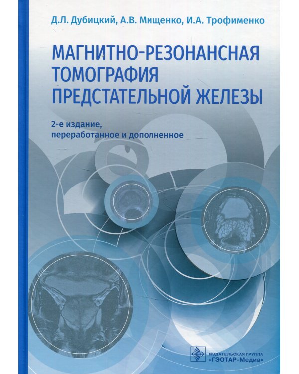 Магнитно-резонансная томография предстательной железы. 2-е изд., перераб. и доп