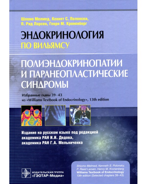 Полиэндокринопатии и паранеопластические синдромы