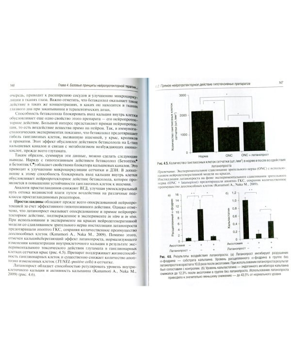 Первичная открытоугольная глаукома. Нейродегенерация и нейропротекция