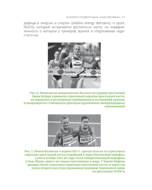 Стрессовые повреждения костной ткани в спорте