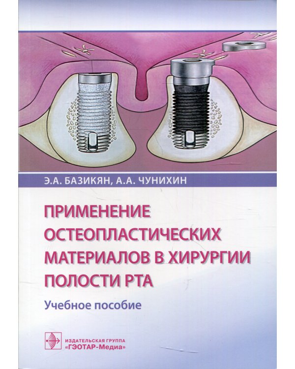 Применение остеопластических материалов в хирургии полости рта: Учебное пособие