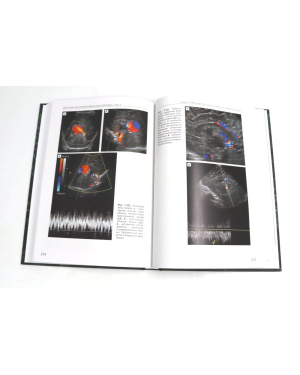 Детская ультразвуковая диагностика: В 5 т. Комплект + Справочник (комплект из 6-ти книг)