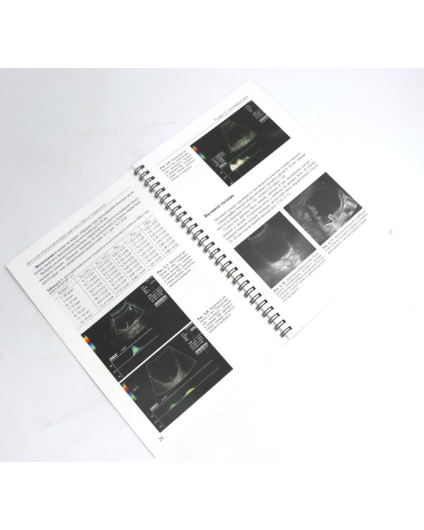 Детская ультразвуковая диагностика: В 5 т. Комплект + Справочник (комплект из 6-ти книг)