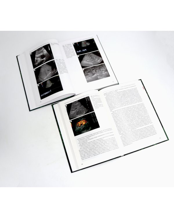 Детская ультразвуковая диагностика: В 5 т. Комплект + Справочник (комплект из 6-ти книг)