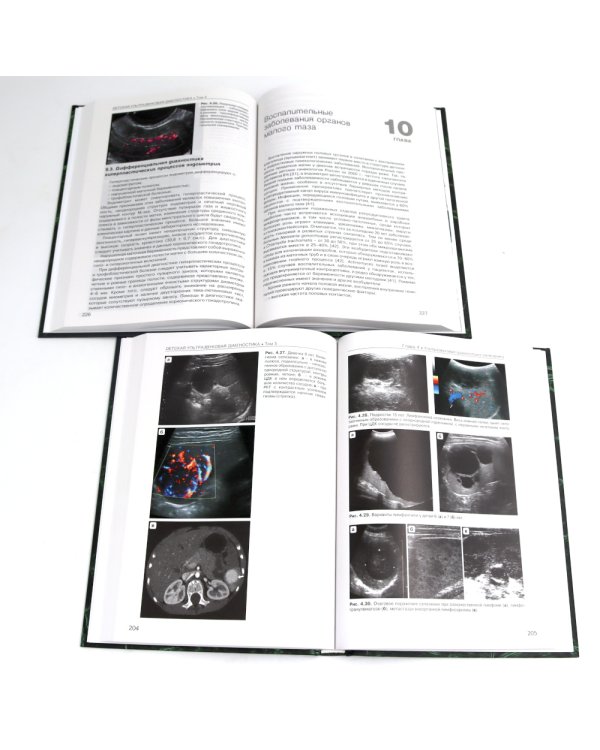 Детская ультразвуковая диагностика: В 5 т. Комплект + Справочник (комплект из 6-ти книг)