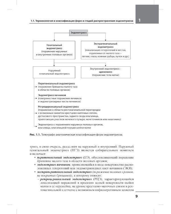 Лечение бесплодия при эндометриозе: взгляд репродуктолога