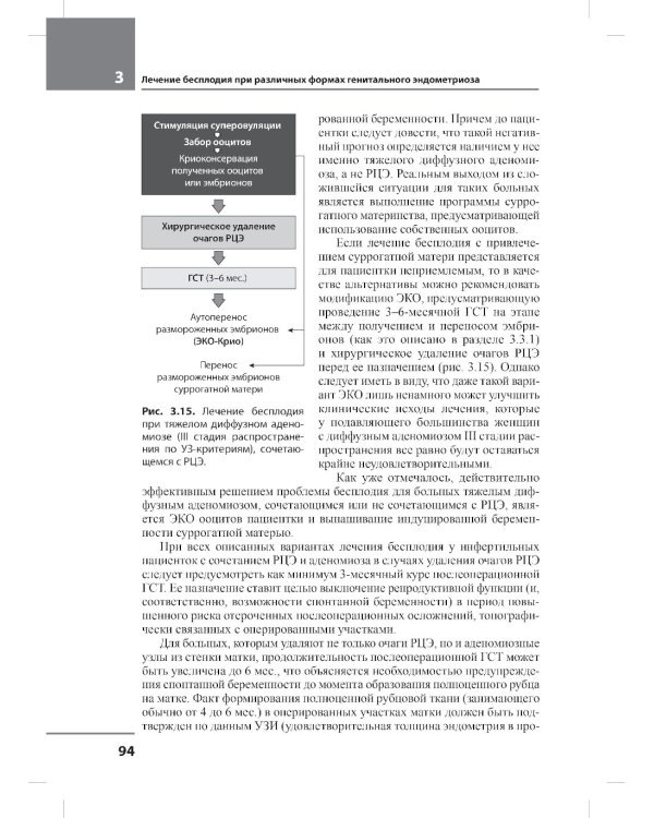Лечение бесплодия при эндометриозе: взгляд репродуктолога