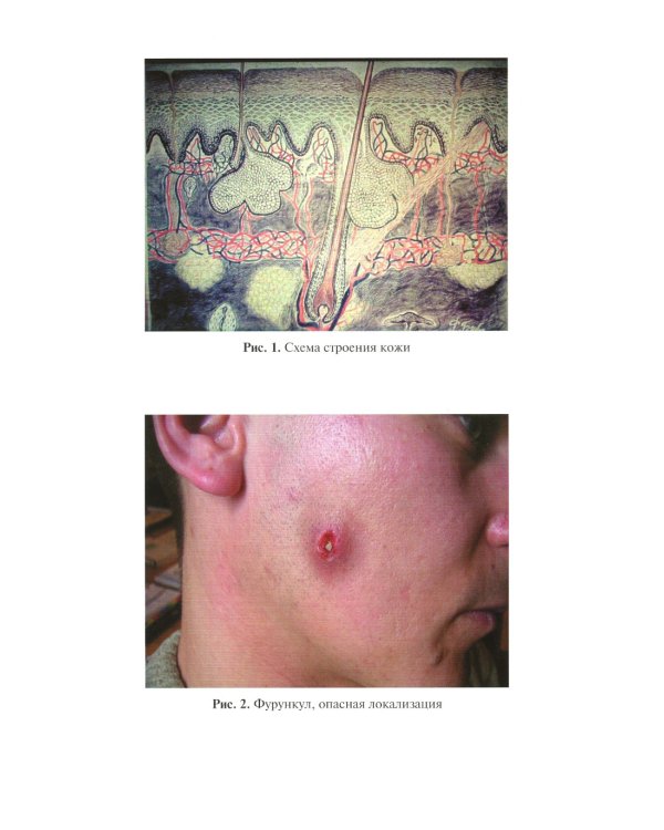 Сестринская помощь в дерматологии и венерологии: Учебник для медицинских училищ и колледжей. 2-е изд., перераб. и доп