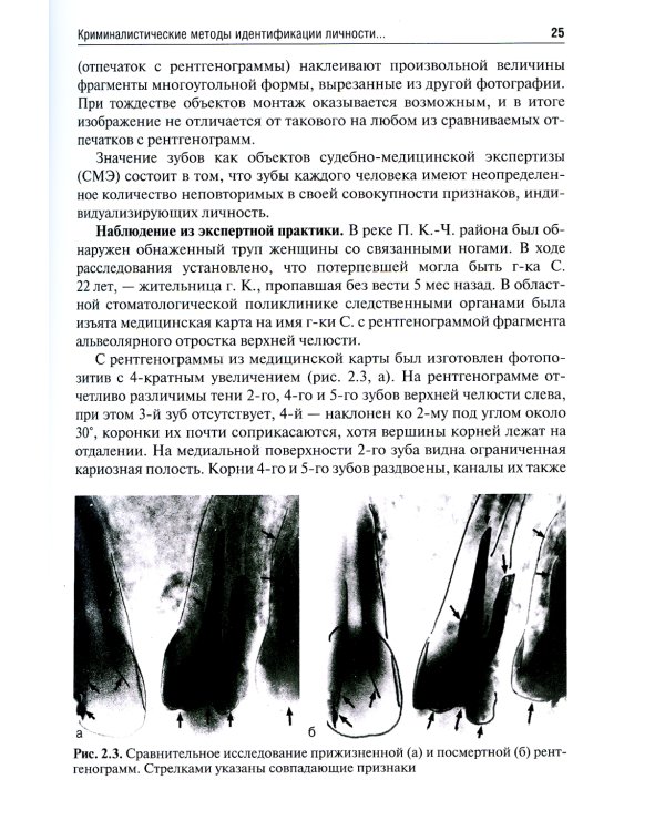 Судебно-медицинская идентификация личности по стоматологическому статусу: Учебное пособие