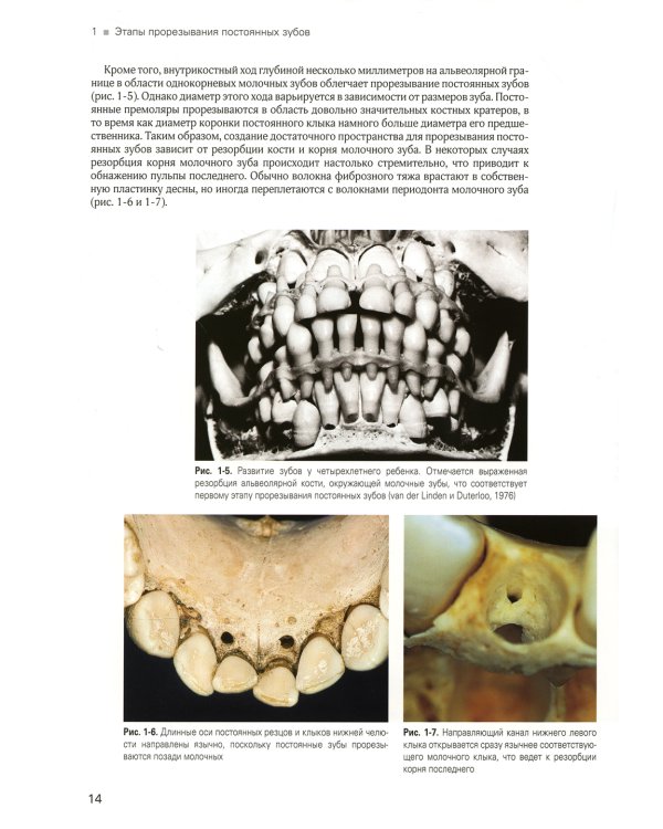 Хирургическое и ортодонтическое лечение ретинированных зубов