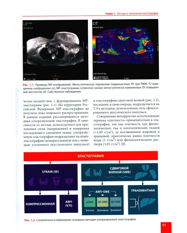 Ультразвуковая эластография. От простого к сложному