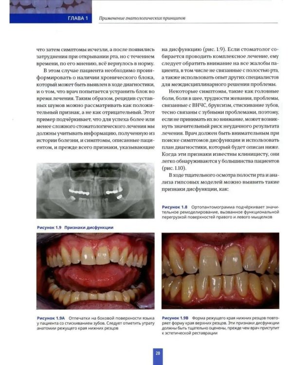 Высота окклюзии в протезировании и ортогнатологии. Интеграция эстетики и функции