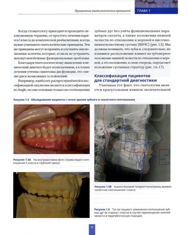 Высота окклюзии в протезировании и ортогнатологии. Интеграция эстетики и функции