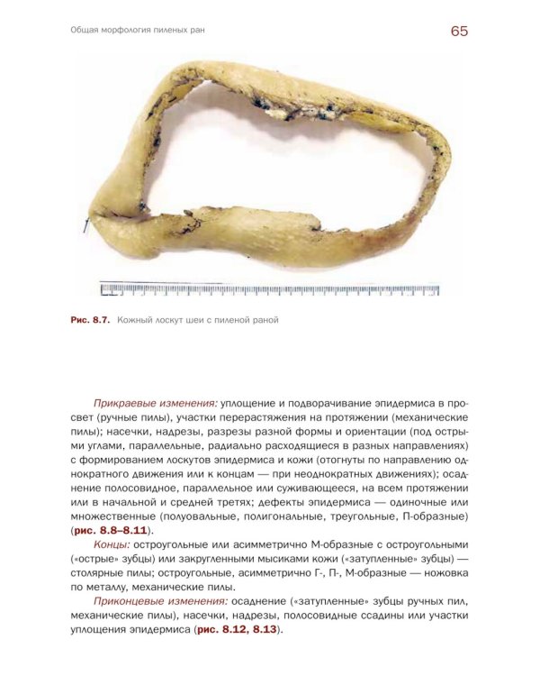 Судебно-медицинская экспертиза травмы от воздействия острых орудий и предметов: Учебное пособие