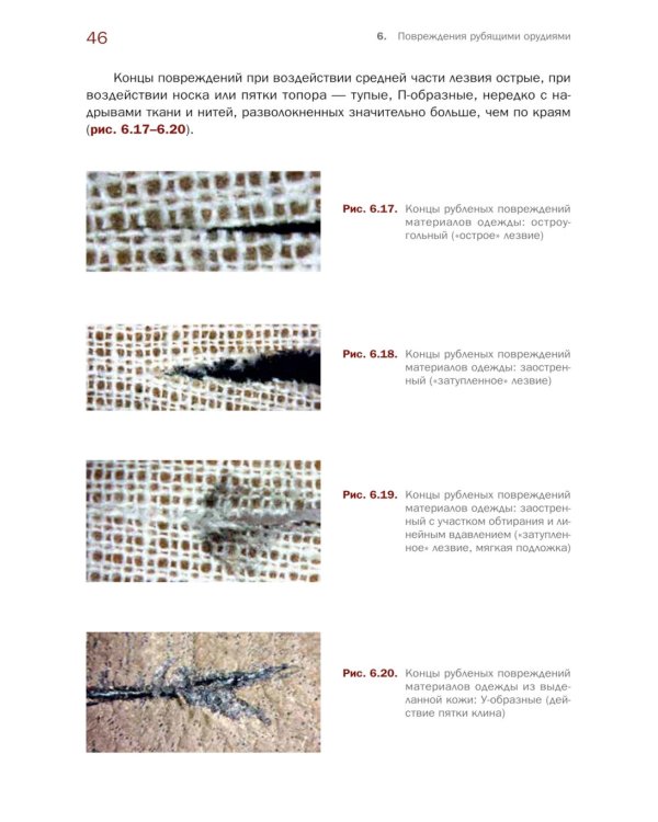 Судебно-медицинская экспертиза травмы от воздействия острых орудий и предметов: Учебное пособие