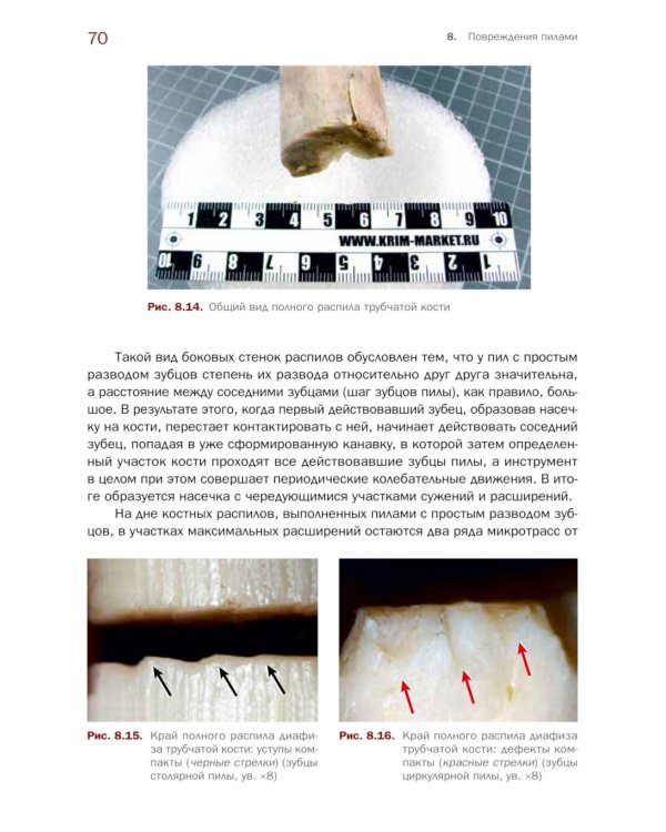 Судебно-медицинская экспертиза травмы от воздействия острых орудий и предметов: Учебное пособие