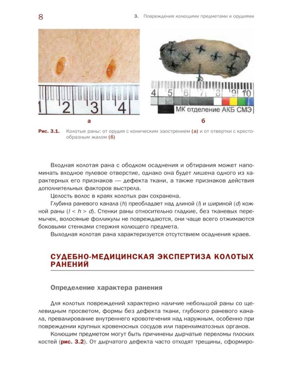 Судебно-медицинская экспертиза травмы от воздействия острых орудий и предметов: Учебное пособие