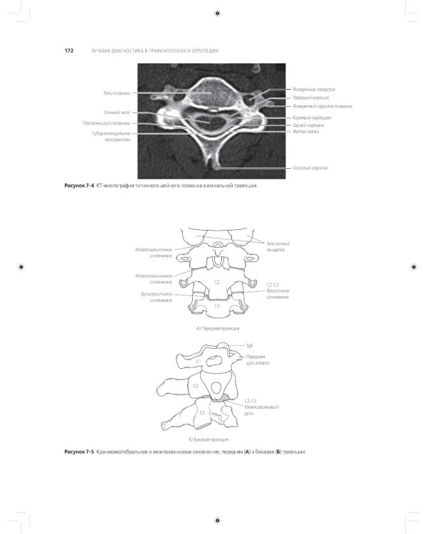 Лучевая диагностика в травматологии и ортопедии: клиническое руководство. В 2 ч. (обл.)