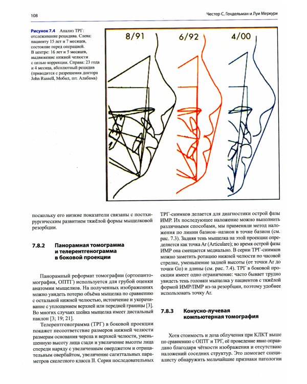 Дисфункции височно-нижнечелюстного сустава в ортодонтии. Клиническое руководство