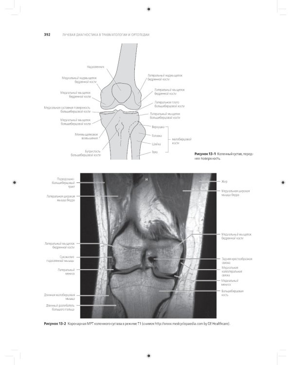 Лучевая диагностика в травматологии и ортопедии: клиническое руководство. В 2 ч. (обл.)