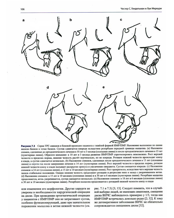 Дисфункции височно-нижнечелюстного сустава в ортодонтии. Клиническое руководство