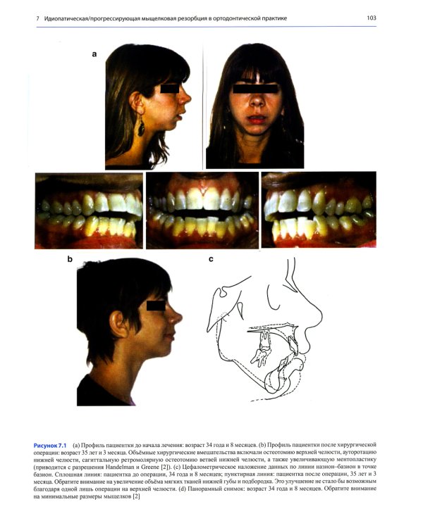 Дисфункции височно-нижнечелюстного сустава в ортодонтии. Клиническое руководство