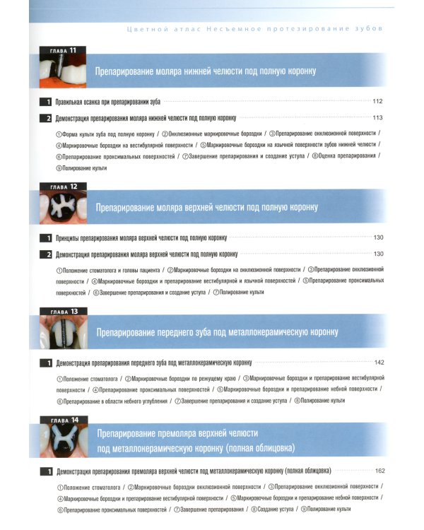 Несъемное протезирование зубов. Цветной атлас