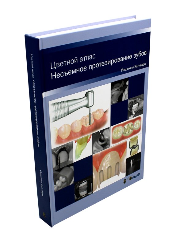 Несъемное протезирование зубов. Цветной атлас