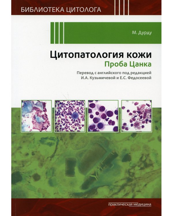 Цитопатология кожи. Проба Цанка