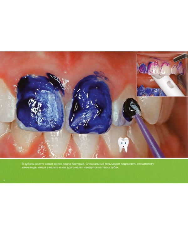 Что происходит у тебя во рту?