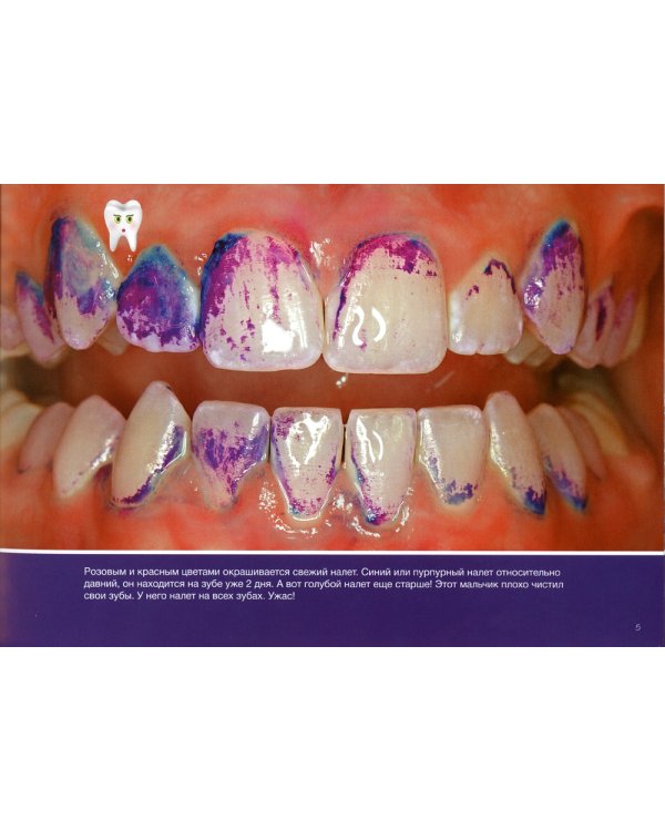 Что происходит у тебя во рту?