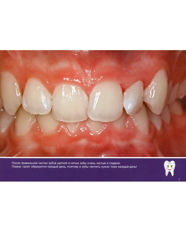 Что происходит у тебя во рту?