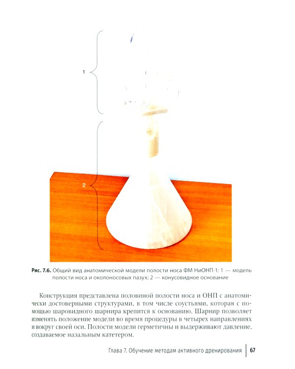 Активное дренирование околоносовых пазух при остром риносинусите