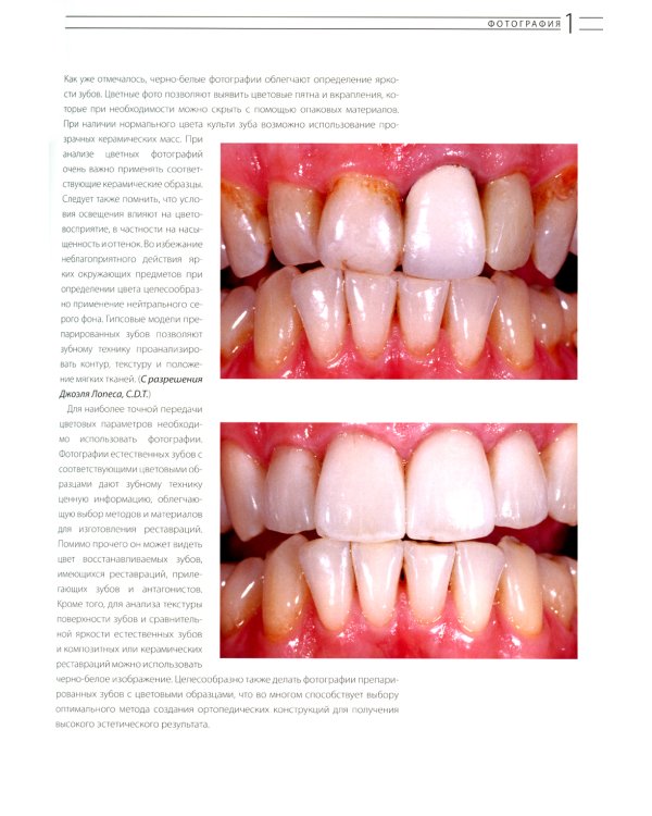 Эстетическая и реставрационная стоматология. Выбор материалов и методов
