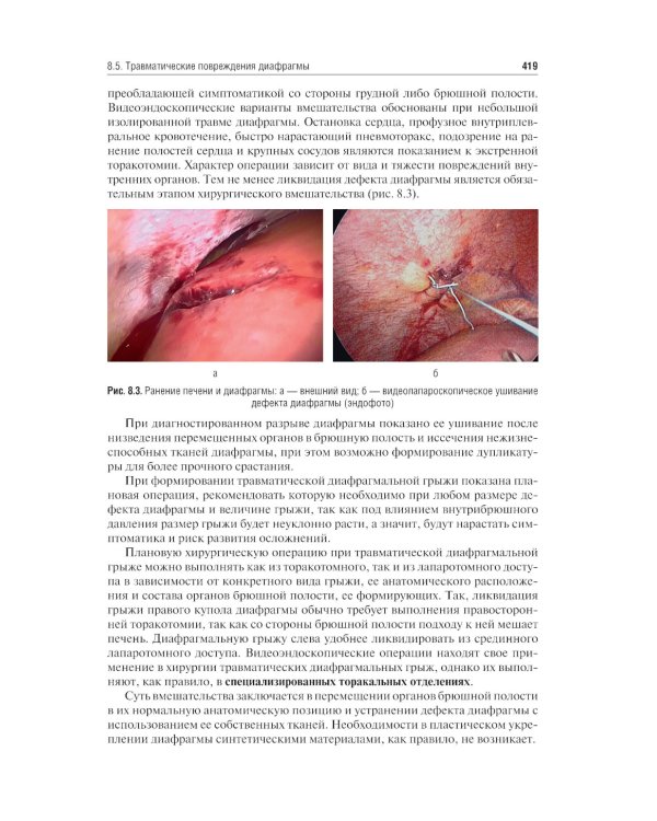 Хирургические болезни: Учебник. В 2 т. Т. 1