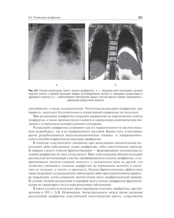 Хирургические болезни: Учебник. В 2 т. Т. 1