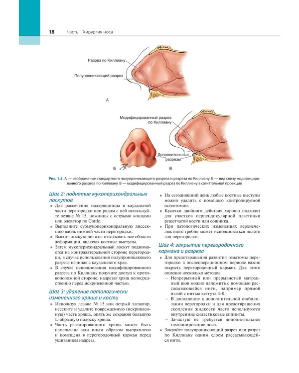 Атлас эндоскопической хирургии околоносовых пазух и основания черепа